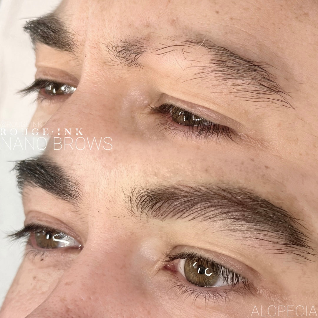 Before and after of a male client who received microblading at Rouge Ink for his alopecia.